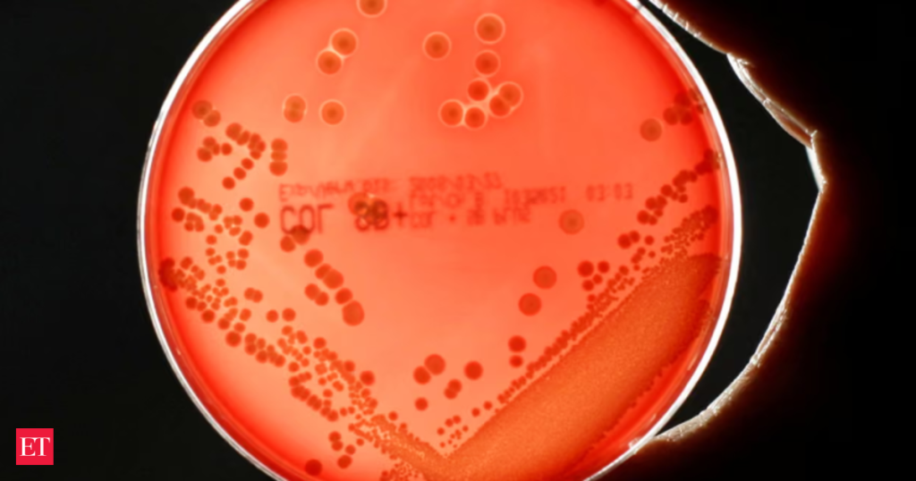 Superbugs could kill millions and trigger $2 trillion economic meltdown by 2050