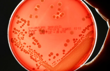 Superbugs could kill millions and trigger $2 trillion economic meltdown by 2050