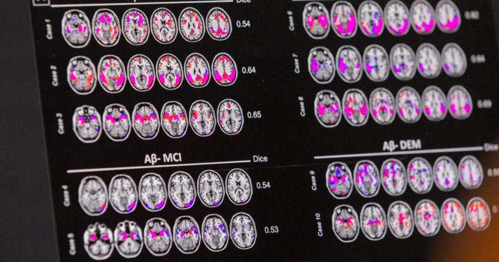 Driving Economic Gains Through Brain Capital
